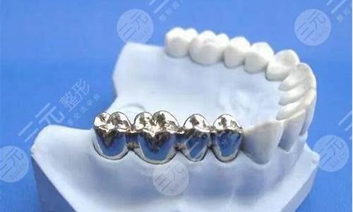 钛合金钢牙价格_钛合金价格牙齿价格